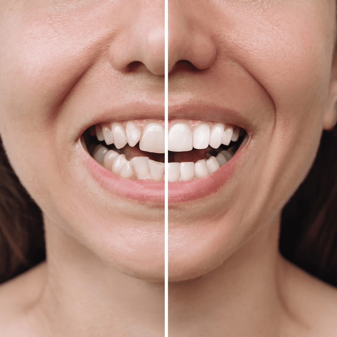Materiales Dentales en Ortodoncia: Fundamentos y Aplicaciones